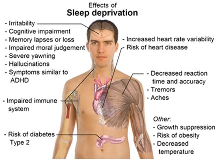 Image of Sleep Deprivation